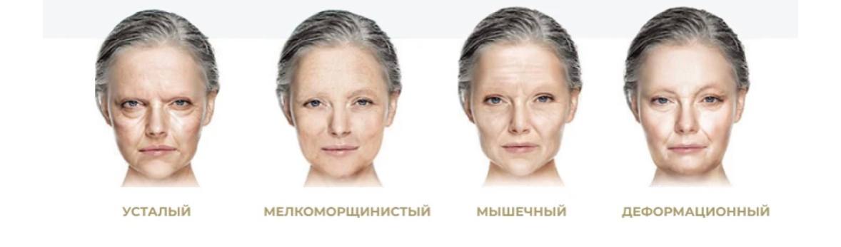 Какой морфотип изображен на фотографиях. Возрастные изменения кожи лица. Усталый морфотип старения. Деформационный Тип старения лица. Морфотипы старения лица.