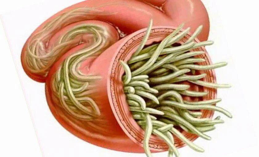 Паразиты в организме картинка