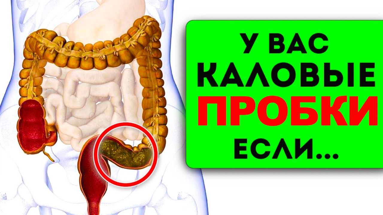 Палеонтология копролиты. Палеонтология копролиты. Каловые камни в кишечнике рентген. Каловые камни форум. Каловые камни в кишечнике.